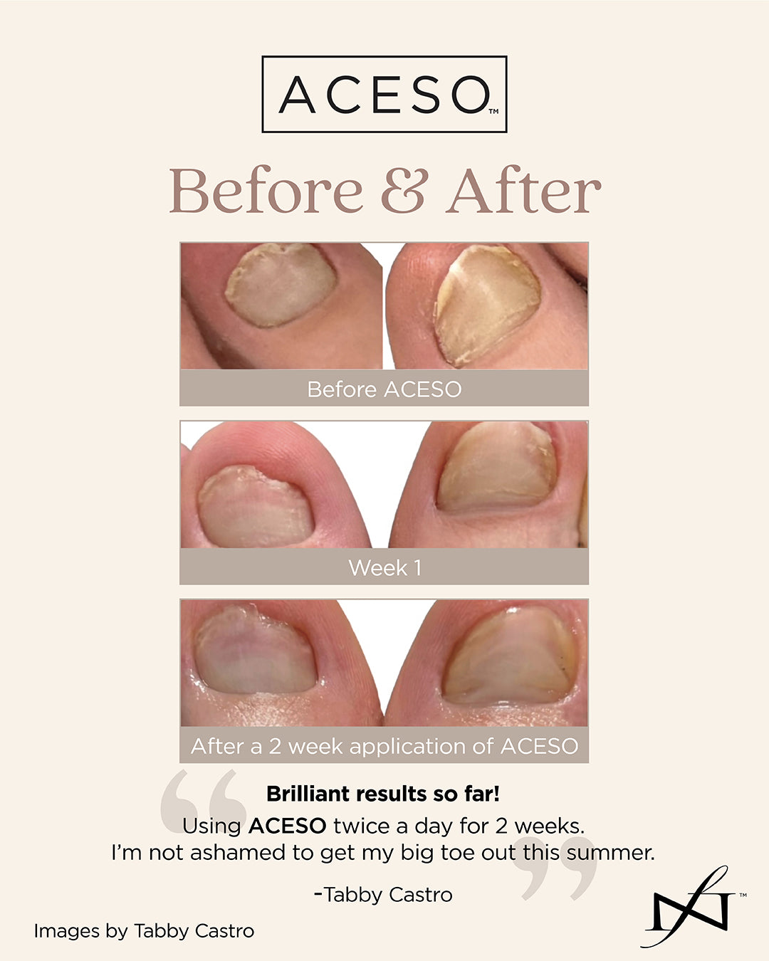 Aceso Nail Bed Wellness