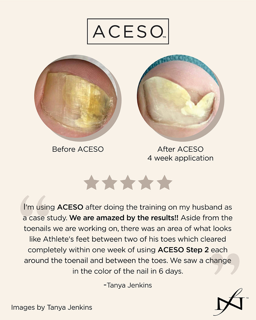 Aceso Nail Bed Wellness